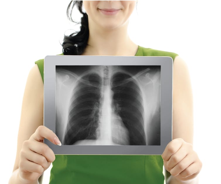 Справка о прохождении флюорографии Справка о прохождении флюорографии